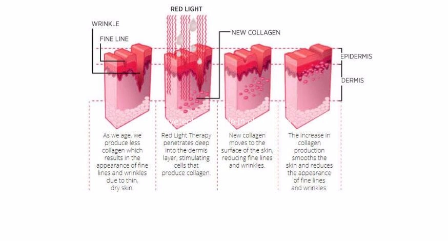 2022 LED Light Therapy PDT Multifunctional Equipment Photodynamic LED Machine Blue Light Therapy PDT Bio Machine